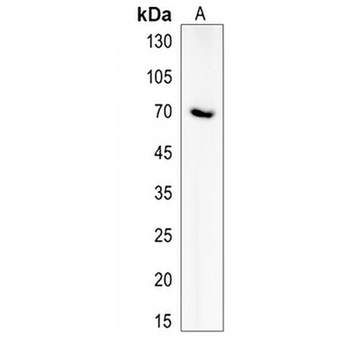 ZNF667 Rabbit Polyclonal Antibody