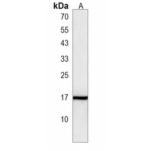 DTD2 Rabbit Polyclonal Antibody