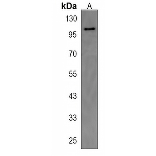 TTC16 Rabbit Polyclonal Antibody