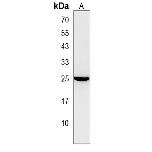 NUDT8 Rabbit Polyclonal Antibody