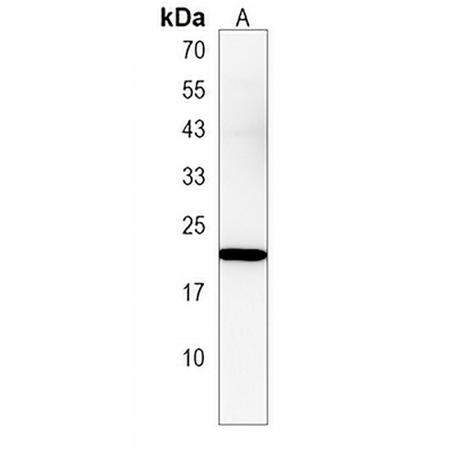 DMRTC1 Rabbit Polyclonal Antibody