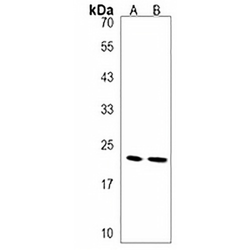 GTSF1 Rabbit Polyclonal Antibody