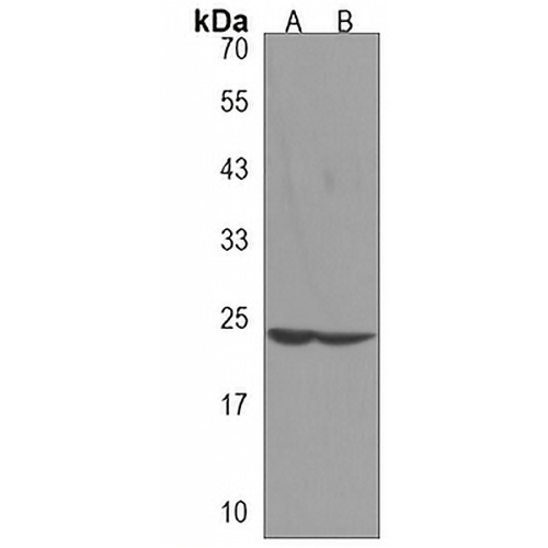JOSD2 Rabbit Polyclonal Antibody
