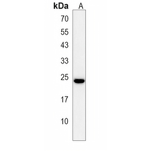 CRIP3 Rabbit Polyclonal Antibody