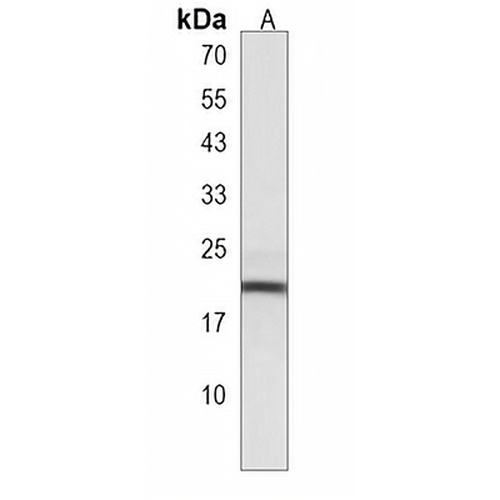CPLX3 Rabbit Polyclonal Antibody