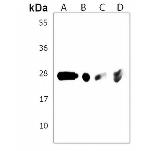 ARV1 Rabbit Polyclonal Antibody