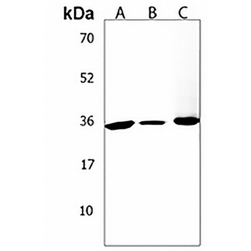 BCKDHB Rabbit Polyclonal Antibody