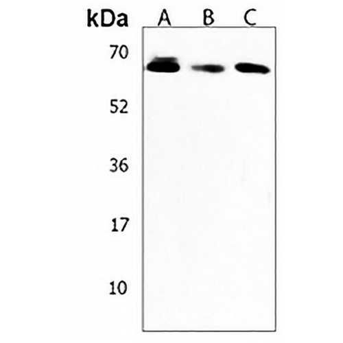 AMY2B Rabbit Polyclonal Antibody