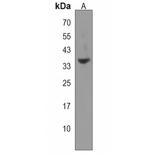 B3GNT4 Rabbit Polyclonal Antibody