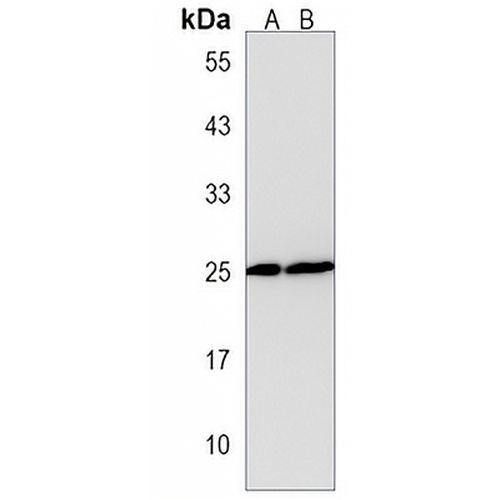 WIBG Rabbit Polyclonal Antibody