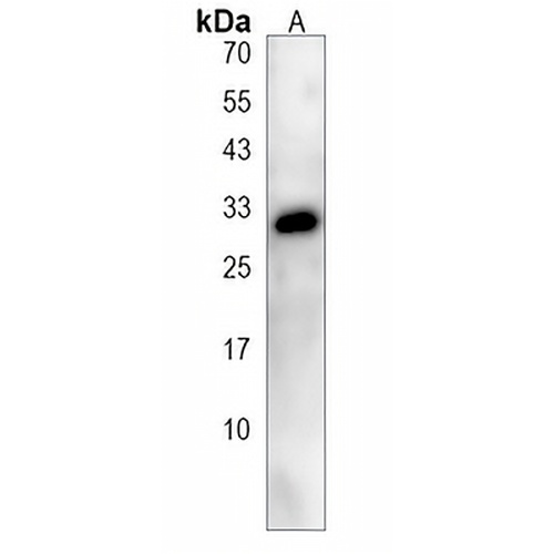 CES1P1 Rabbit Polyclonal Antibody