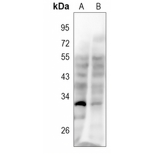 CD37 Rabbit Polyclonal Antibody