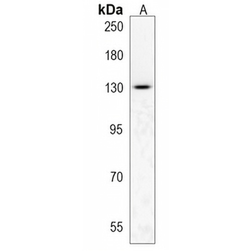 TLL1 Rabbit Polyclonal Antibody