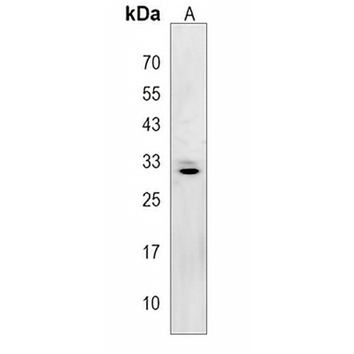 ZC4H2 Rabbit Polyclonal Antibody