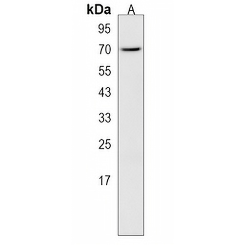 CLPX Rabbit Polyclonal Antibody