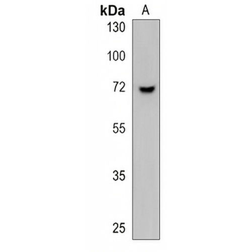 ALS2CR11 Rabbit Polyclonal Antibody