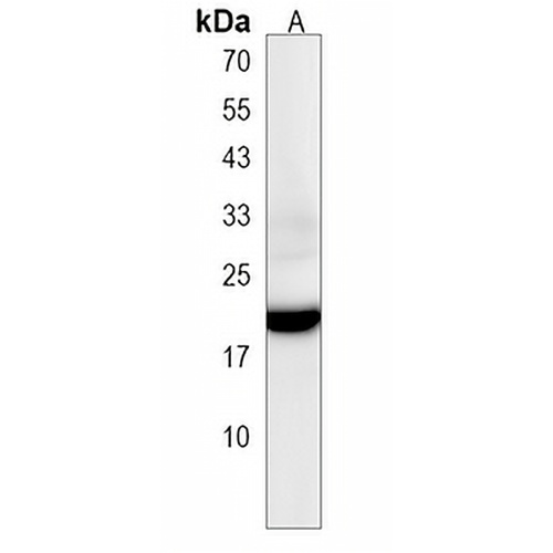 ORMDL2 Rabbit Polyclonal Antibody