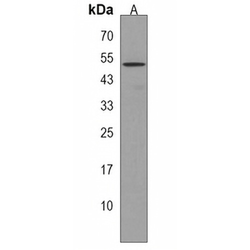 TAPT1 Rabbit Polyclonal Antibody