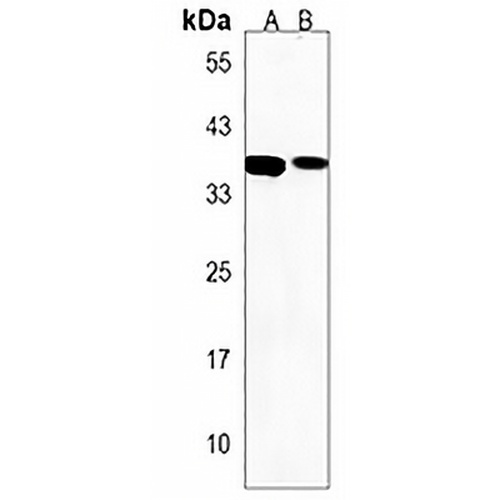 CCDC122 Rabbit Polyclonal Antibody