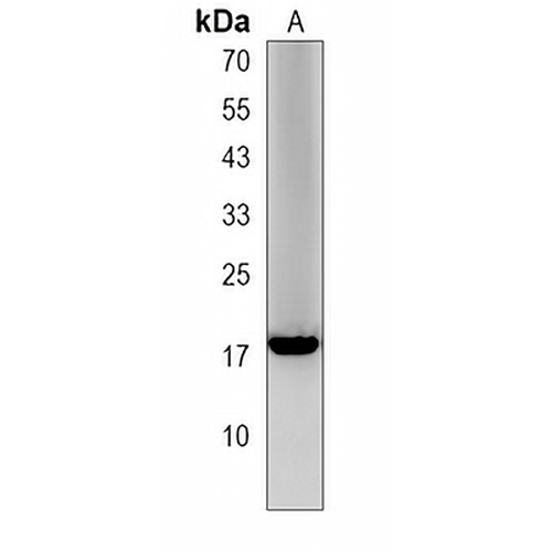 LCE1A Rabbit Polyclonal Antibody