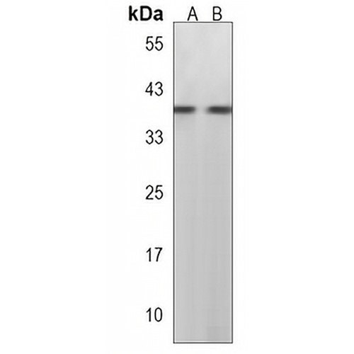 SLC35G5 Rabbit Polyclonal Antibody
