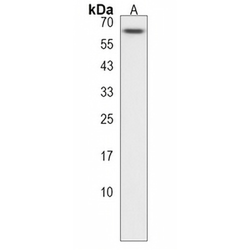 ZNF674 Rabbit Polyclonal Antibody