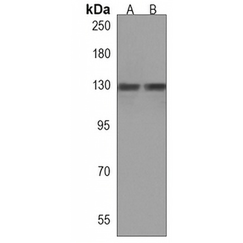 BCL11B Rabbit Polyclonal Antibody