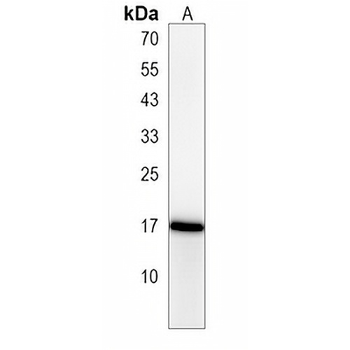 NDUFAF3 Rabbit Polyclonal Antibody