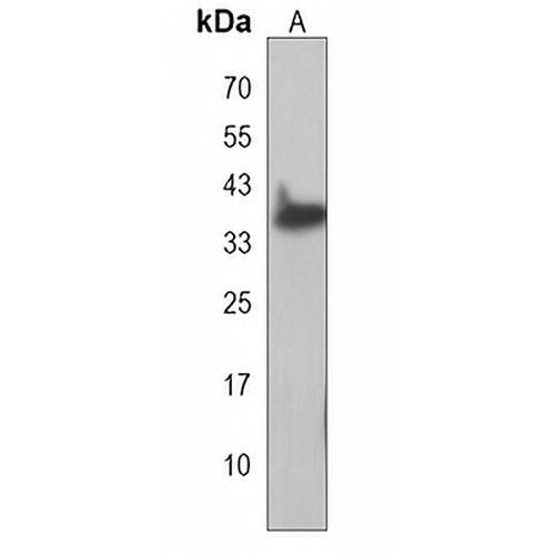 HMCES Rabbit Polyclonal Antibody