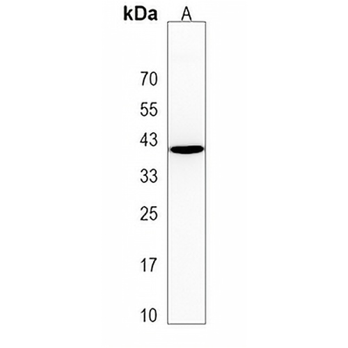 C17orf59 Rabbit Polyclonal Antibody