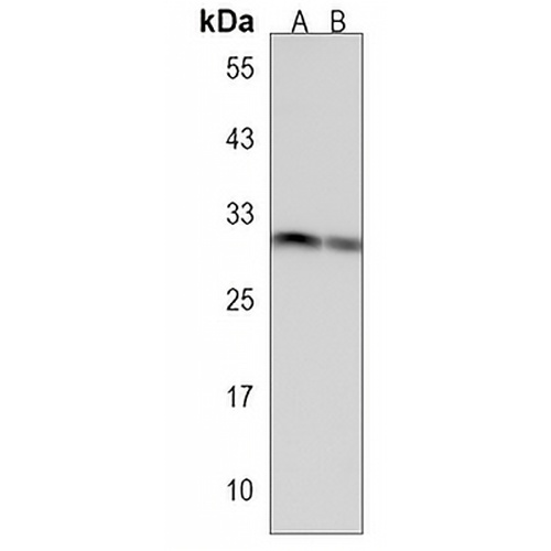 UNC119B Rabbit Polyclonal Antibody