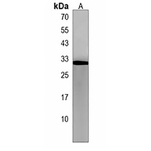 RILPL2 Rabbit Polyclonal Antibody