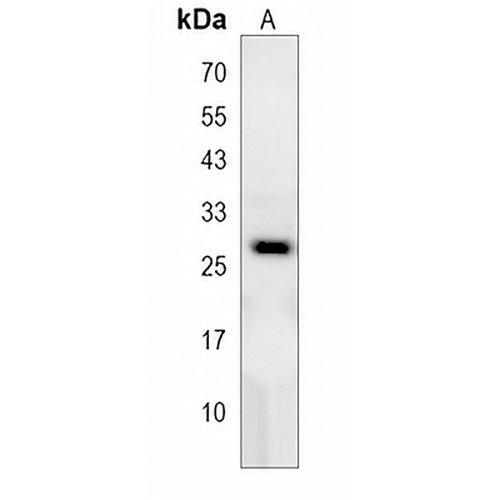 RPEL1 Rabbit Polyclonal Antibody