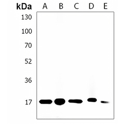 IFITM5 Rabbit Polyclonal Antibody