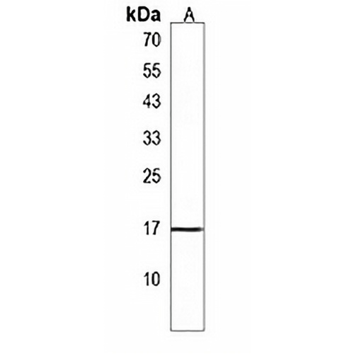 CST9 Rabbit Polyclonal Antibody