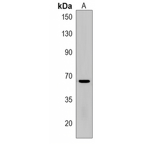 TGM6 Rabbit Polyclonal Antibody
