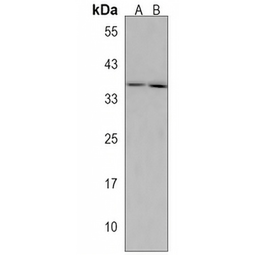 OR1J4 Rabbit Polyclonal Antibody