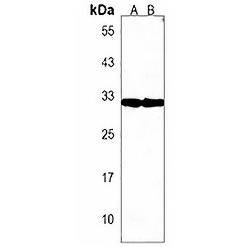 OR5L2 Rabbit Polyclonal Antibody