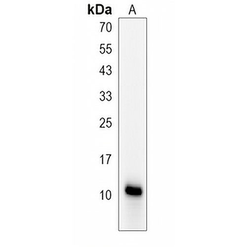 CGRP-1 Rabbit Polyclonal Antibody