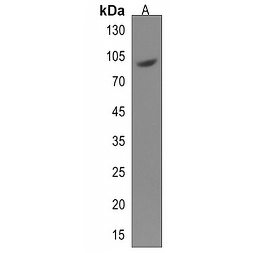 ACAP1 Rabbit Polyclonal Antibody