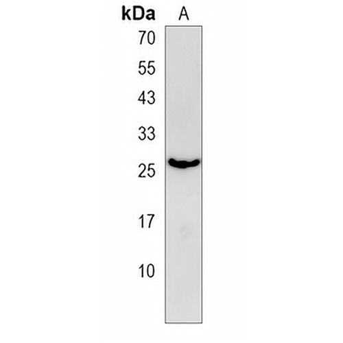 EMC7 Rabbit Polyclonal Antibody