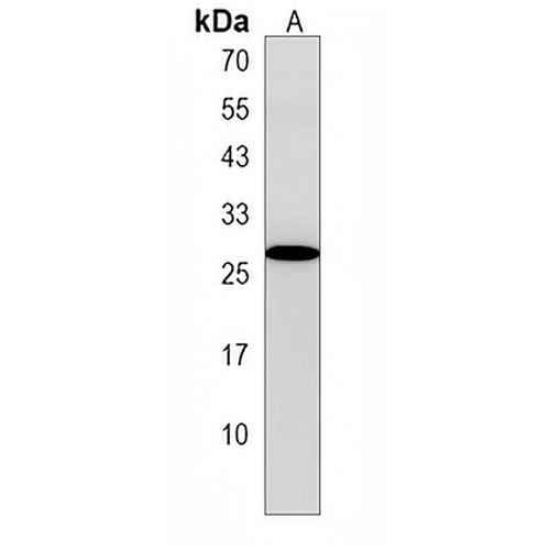 MBD3L2 Rabbit Polyclonal Antibody