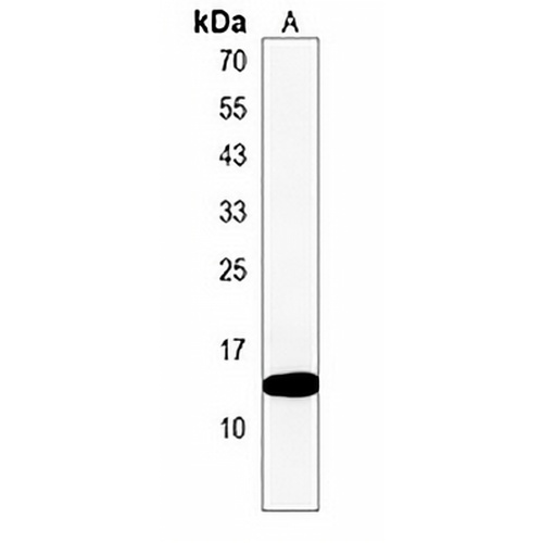KRTCAP2 Rabbit Polyclonal Antibody