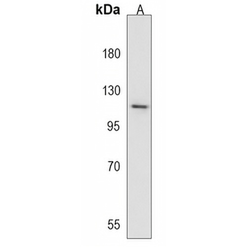 GIGYF1 Rabbit Polyclonal Antibody