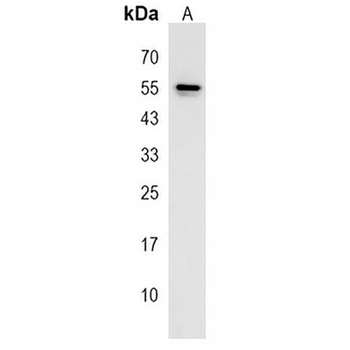 KRT25 Rabbit Polyclonal Antibody