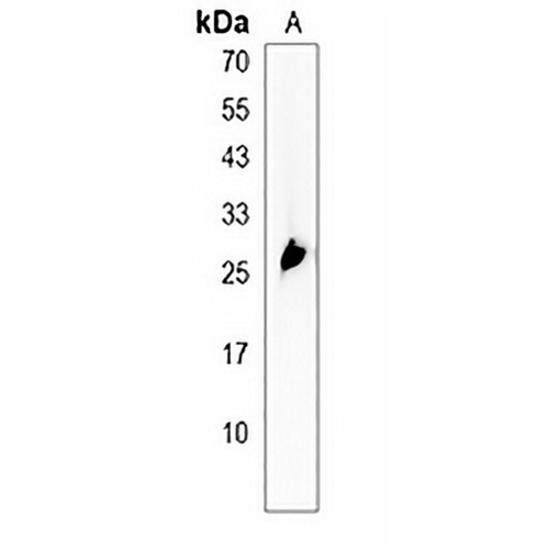 GAGE12B Rabbit Polyclonal Antibody