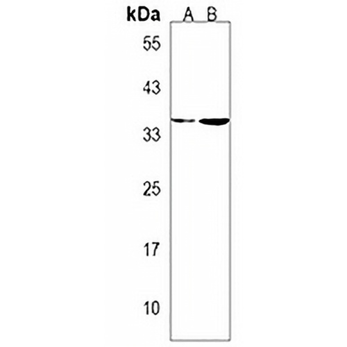 OR10J5 Rabbit Polyclonal Antibody