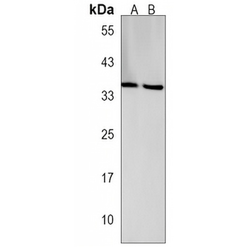MTHFD2L Rabbit Polyclonal Antibody