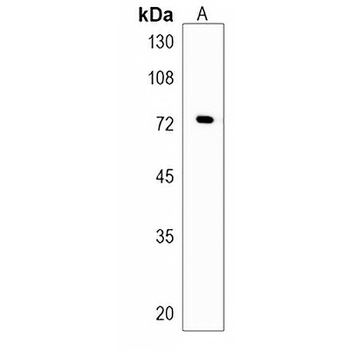 FBXO21 Rabbit Polyclonal Antibody
