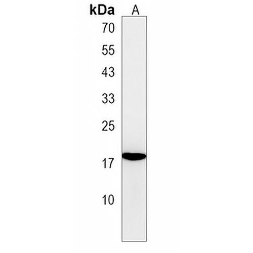 FAM218A Rabbit Polyclonal Antibody